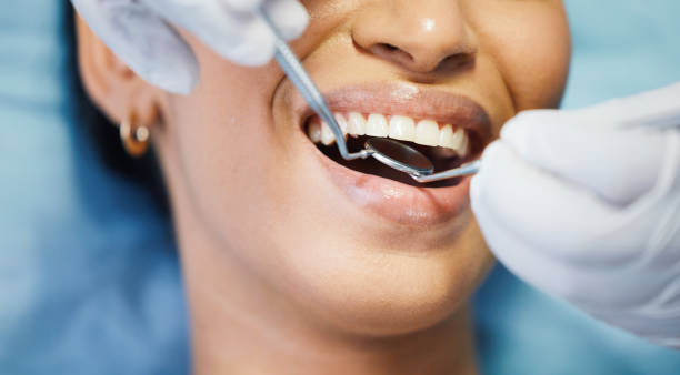 Best Broken or Chipped Tooth Repair in Miami Springs, FL