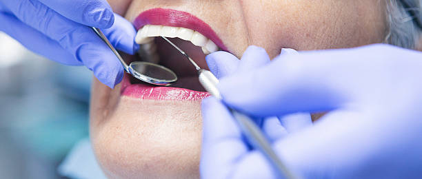 Best Broken or Chipped Tooth Repair in Miami Springs, FL